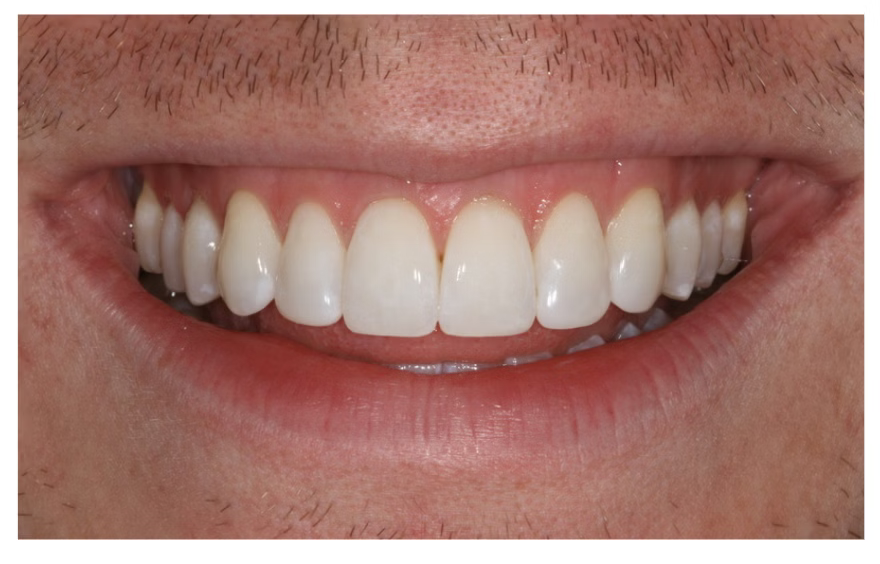 After dental treatment