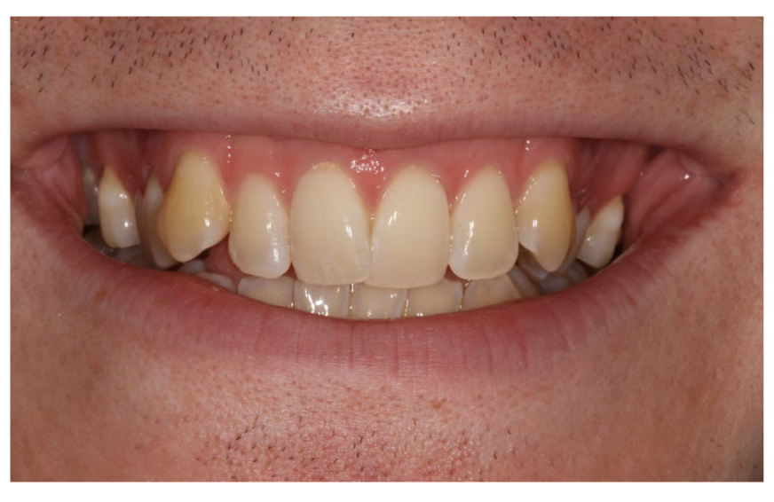Before dental treatment